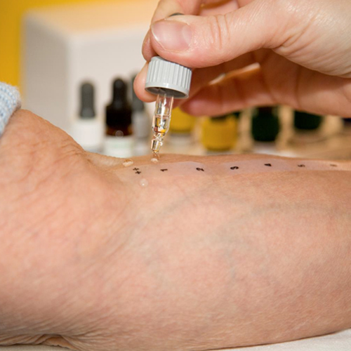 Immunology and Allergy