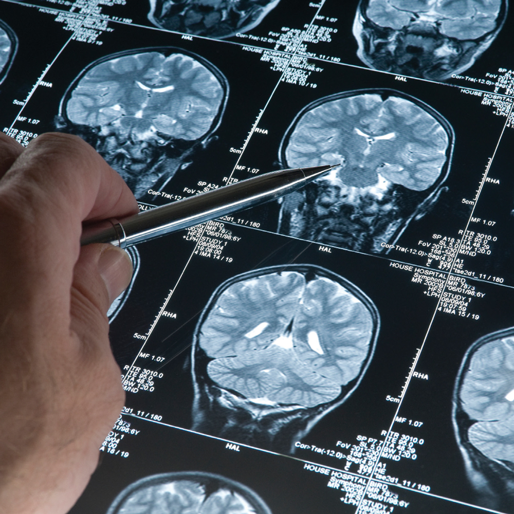 Advanced Training in Neurology