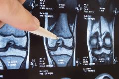 arthroscopy of the knee