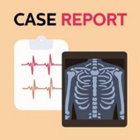 Case report new Case report new