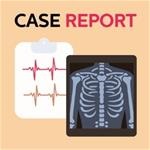 Case report Case report