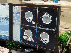 Gandali MRI