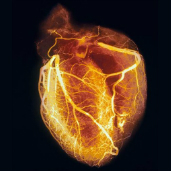 Ep35: Acute Coronary Syndrome Part 1—Diagnosis