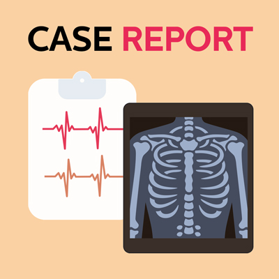 [Case Report] 68yo with cardiometabolic risk factors and transient monocular vision loss